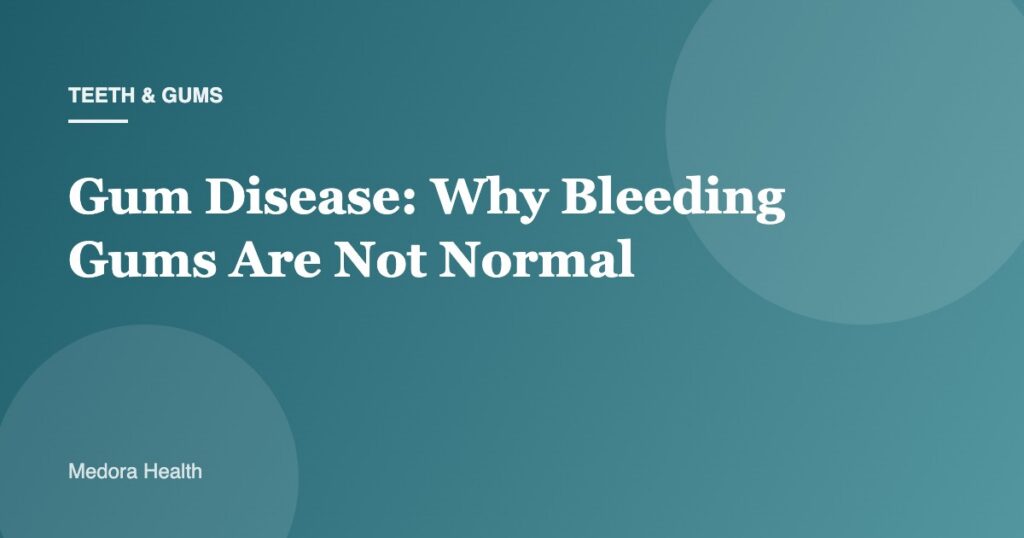 Gum Disease: Why Bleeding Gums Are Not Normal