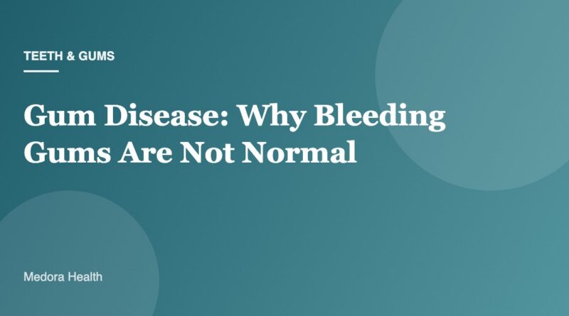 Gum Disease: Why Bleeding Gums Are Not Normal