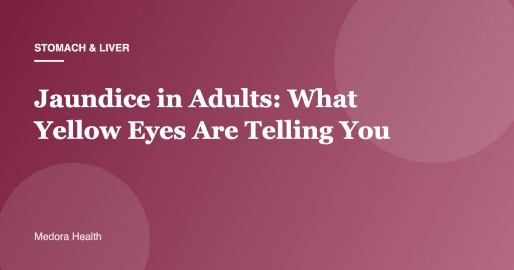 Jaundice in Adults: What Yellow Eyes Are Telling You